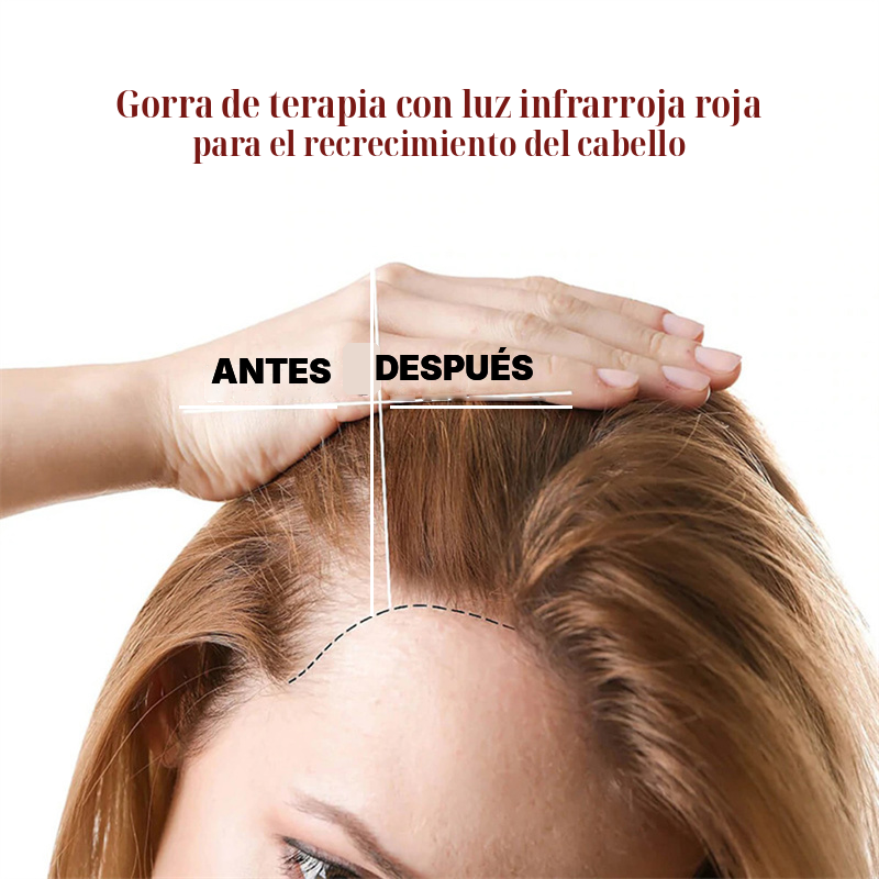 Gorra LED Capilar Luz Roja y Azul | Cuidado Estético en Casa