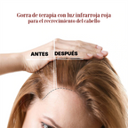 Gorra LED Capilar Luz Roja y Azul | Cuidado Estético en Casa